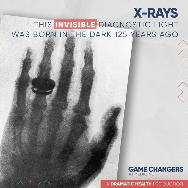 X-Rays-This invisible diagnostic light was born in the dark 125 years ago