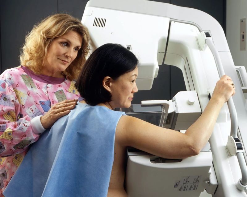 Breast scan optimised Ongoing Breast Cancer Screening
